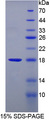 FABP3 / H-FABP Protein - Recombinant  Fatty Acid Binding Protein 3, Muscle And Heart By SDS-PAGE