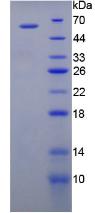 FLT1 / VEGFR1 Protein - Recombinant Vascular Endothelial Growth Factor Receptor 1 By SDS-PAGE