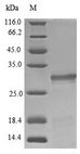 GH / Growth Hormone Protein - (Tris-Glycine gel) Discontinuous SDS-PAGE (reduced) with 5% enrichment gel and 15% separation gel.