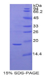 Gkn3 / Gastrokine 3 Protein - Recombinant Gastrokine 3 By SDS-PAGE