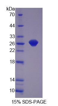 GSTP1 / GST Pi Protein - Recombinant  Glutathione S Transferase Pi By SDS-PAGE