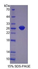 GSTP1 / GST Pi Protein - Recombinant  Glutathione S Transferase Pi By SDS-PAGE