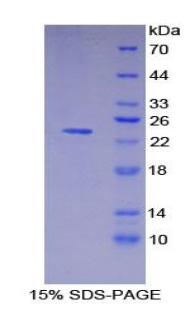 HLA-DRA Protein - Recombinant Major Histocompatibility Complex Class II DR Alpha By SDS-PAGE