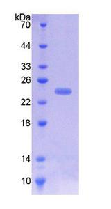 ICAM-1 / CD54 Protein - Recombinant  Intercellular Adhesion Molecule 1 By SDS-PAGE
