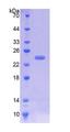ICAM-1 / CD54 Protein - Recombinant  Intercellular Adhesion Molecule 1 By SDS-PAGE