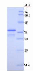 IGF1 Protein - Recombinant Insulin Like Growth Factor 1 By SDS-PAGE