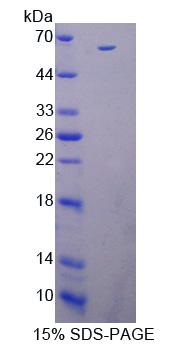 IL12B / IL12 p40 Protein - Recombinant  Interleukin 12B By SDS-PAGE