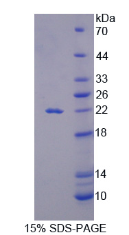 IL18 Protein - Recombinant Interleukin 18 By SDS-PAGE