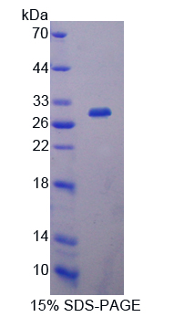 IL2RA / CD25 Protein - Recombinant  Interleukin 2 Receptor Alpha By SDS-PAGE