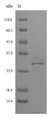 IL4R / CD124 Protein - (Tris-Glycine gel) Discontinuous SDS-PAGE (reduced) with 5% enrichment gel and 15% separation gel.