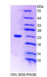 LGB / Beta-Lactoglobulin Protein - Recombinant Beta-Lactoglobulin By SDS-PAGE