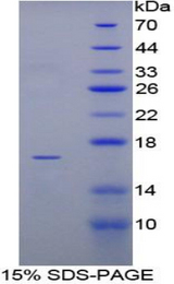 LTA / TNF Beta Protein - Recombinant Tumor Necrosis Factor Beta By SDS-PAGE