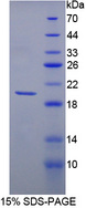 MMP13 Protein - Recombinant  Matrix Metalloproteinase 13 By SDS-PAGE