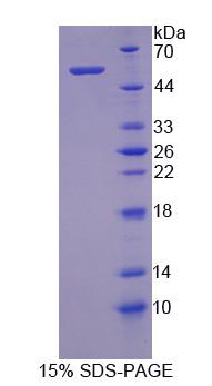 MMP3 Protein - Recombinant  Matrix Metalloproteinase 3 By SDS-PAGE