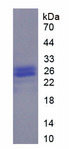 ORM1 / Orosomucoid Protein - Recombinant  Alpha-1-Acid Glycoprotein By SDS-PAGE