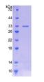 P450SCC / CYP11A1 Protein - Recombinant  Cytochrome P450 11A1 By SDS-PAGE