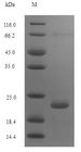 PMAP-36 Protein - (Tris-Glycine gel) Discontinuous SDS-PAGE (reduced) with 5% enrichment gel and 15% separation gel.