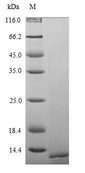 PTH / Parathyroid Hormone Protein - (Tris-Glycine gel) Discontinuous SDS-PAGE (reduced) with 5% enrichment gel and 15% separation gel.