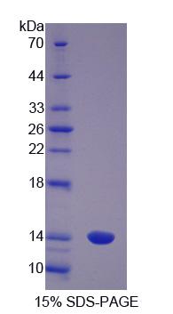 S100A8 / MRP8 Protein - Recombinant  S100 Calcium Binding Protein A8 By SDS-PAGE
