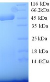 SELE / CD62E / E-selectin Protein
