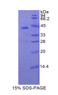 SELE / CD62E / E-selectin Protein - Recombinant Selectin, Endothelium By SDS-PAGE