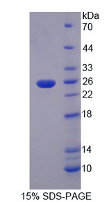 TF / Transferrin Protein - Recombinant Transferrin By SDS-PAGE