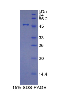 TIMP4 Protein - Recombinant Tissue Inhibitors Of Metalloproteinase 4 By SDS-PAGE