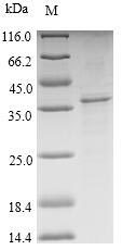 TSPO / PBR Protein - (Tris-Glycine gel) Discontinuous SDS-PAGE (reduced) with 5% enrichment gel and 15% separation gel.