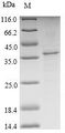 TSPO / PBR Protein - (Tris-Glycine gel) Discontinuous SDS-PAGE (reduced) with 5% enrichment gel and 15% separation gel.