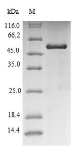 Uricase Protein - (Tris-Glycine gel) Discontinuous SDS-PAGE (reduced) with 5% enrichment gel and 15% separation gel.