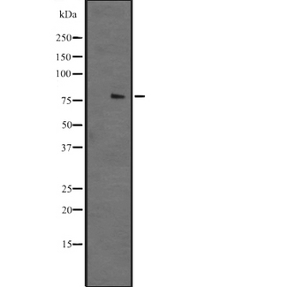 PIG1 / NUFIP2 Antibody - Western blot analysis of NUFIP2 expression in NTERA2 cells lysate. The lane on the left is treated with the antigen-specific peptide.