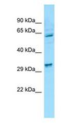 PIG8 / EI24 Antibody - PIG8 / EI24 antibody Western Blot of HeLa.  This image was taken for the unconjugated form of this product. Other forms have not been tested.