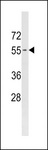 PIGB Antibody - PIGB Antibody western blot of HeLa cell line lysates (35 ug/lane). The PIGB antibody detected the PIGB protein (arrow).