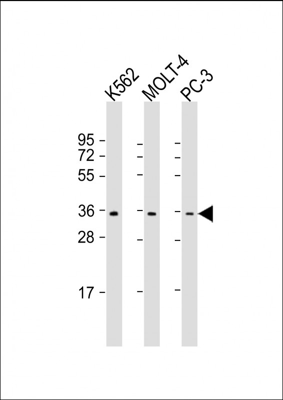 PIGC Antibody - All lanes: Anti-PIGC Antibody (C-Term) at 1:1000 dilution Lane 1: K562 whole cell lysate Lane 2: MOLT-4 whole cell lysate Lane 3: PC-3 whole cell lysate Lysates/proteins at 20 µg per lane. Secondary Goat Anti-Rabbit IgG, (H+L), Peroxidase conjugated at 1/10000 dilution. Predicted band size: 34 kDa Blocking/Dilution buffer: 5% NFDM/TBST.
