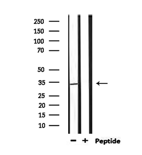 PIGC Antibody