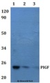 PIGF Antibody - Western blot of PIGF antibody at 1:500 dilution. Lane 1: HEK293T whole cell lysate. Lane 2: RAW264.7 whole cell lysate.