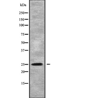 PIGF Antibody - Western blot analysis of PIGF using HuvEc whole cells lysates