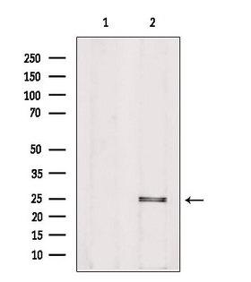 PIGF Antibody - Western blot analysis of extracts of HeLa cells using PIGF antibody. Lane 1 was treated with the blocking peptide.