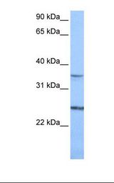 PIGF Antibody - Jurkat cell lysate. Antibody concentration: 1.0 ug/ml. Gel concentration: 12%.  This image was taken for the unconjugated form of this product. Other forms have not been tested.