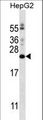 PIGH Antibody - PIGH Antibody western blot of HepG2 cell line lysates (35 ug/lane). The PIGH antibody detected the PIGH protein (arrow).