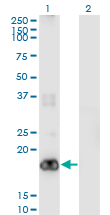 PIGH Antibody - Western Blot analysis of PIGH expression in transfected 293T cell line by PIGH monoclonal antibody (M01), clone 2F8.Lane 1: PIGH transfected lysate (Predicted MW: 21.1 KDa).Lane 2: Non-transfected lysate.