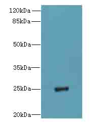 PIGH Antibody - Western blot. All lanes: PIGH antibody at 4 ug/ml+Mos- kidney tissue Goat polyclonal to rabbit at 1:10000 dilution. Predicted band size: 21 kDa. Observed band size: 21 kDa.