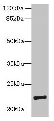 PIGH Antibody - Western blot All lanes: PIGH antibody at 4µg/ml + Mouse kidney tissue Secondary Goat polyclonal to rabbit IgG at 1/10000 dilution Predicted band size: 21 kDa Observed band size: 21 kDa