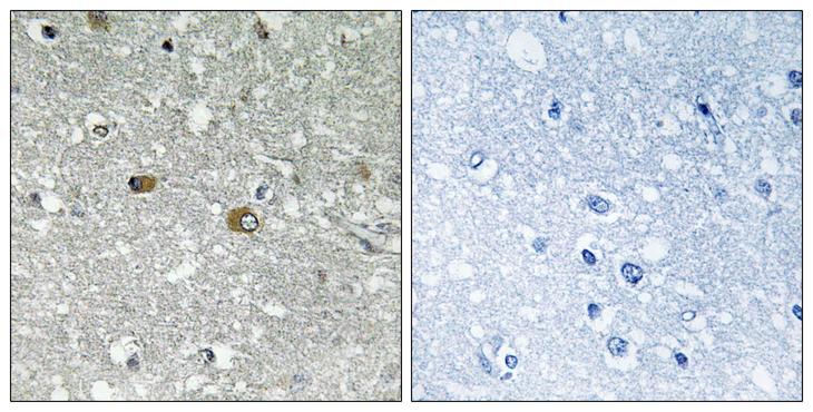 PIGH Antibody - Peptide - + Immunohistochemistry analysis of paraffin-embedded human brain tissue using PIGH antibody.