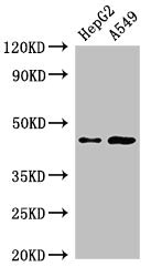 PIGK Antibody - Western Blot Positive WB detected in:HepG2 whole cell lysate,A549 whole cell lysate All Lanes:PIGK antibody at 2.5µg/ml Secondary Goat polyclonal to rabbit IgG at 1/50000 dilution Predicted band size: 46,37 KDa Observed band size: 46 KDa