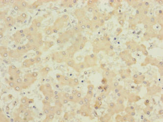 PIGL Antibody - Immunohistochemistry of paraffin-embedded human liver tissue using PIGL Antibody at dilution of 1:100
