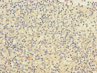 PIGL Antibody - Immunohistochemistry of paraffin-embedded human spleen tissue using PIGL Antibody at dilution of 1:100