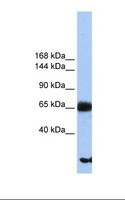 PIGO Antibody - Hela cell lysate. Antibody concentration: 1.0 ug/ml. Gel concentration: 6%-18%.  This image was taken for the unconjugated form of this product. Other forms have not been tested.