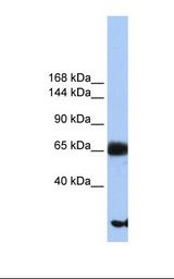 PIGO Antibody - Hela cell lysate. Antibody concentration: 1.0 ug/ml. Gel concentration: 6%-18%.  This image was taken for the unconjugated form of this product. Other forms have not been tested.