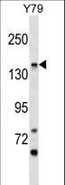PIGO Antibody - PIGO Antibody western blot of Y79 cell line lysates (35 ug/lane). The PIGO antibody detected the PIGO protein (arrow).